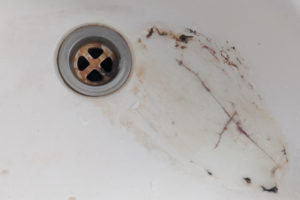 porzellan-waschbecken-reparieren