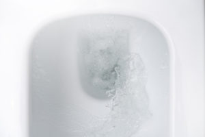 toilettenspuelung-spritzt